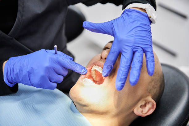 Best Emergency Dental Extractions in Slater Marietta, SC