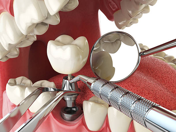 Best Emergency Dental Care for Abscessed Tooth in Slater Marietta, SC